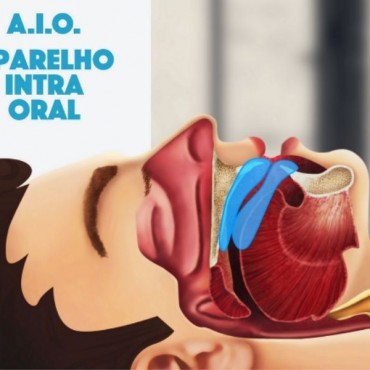 Aparelho de Apneia do Sono em Setor Sul - GO