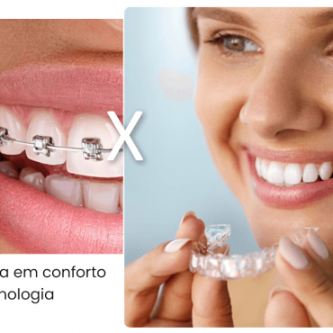 Aparelho Invisível em Setor Sul - GO