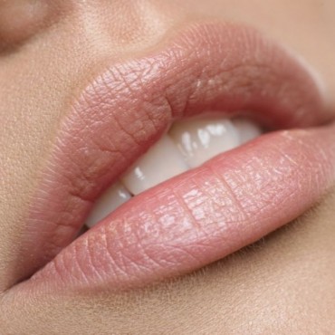 Preenchimento Labial em Setor Sul - GO