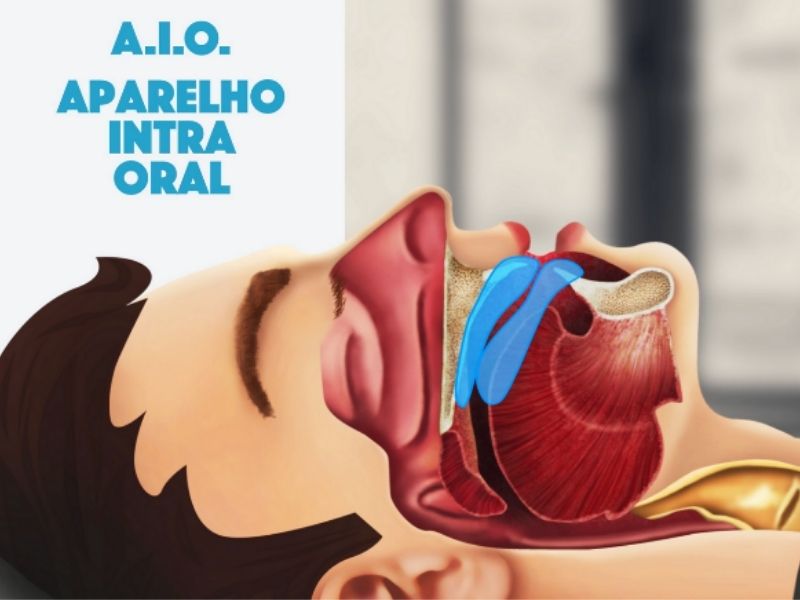Aparelho de Apneia do Sono