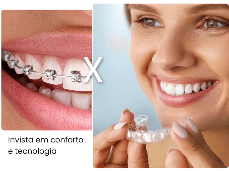 Aparelho Invisível